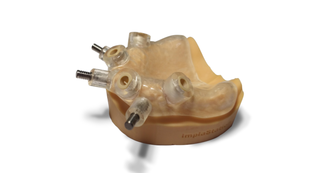 Mucosa-Supported Surgical Guide