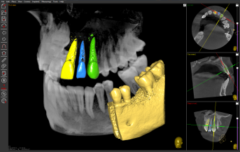 DICOM convertion