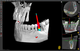 DICOM cutting