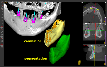 DICOM segmentation