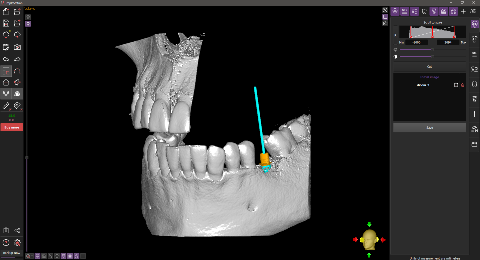 DICOM cutting