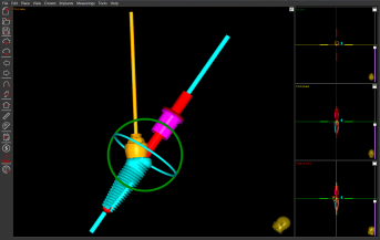 Working with implants with inclined platform