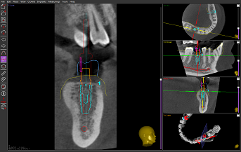 Rotating slice view