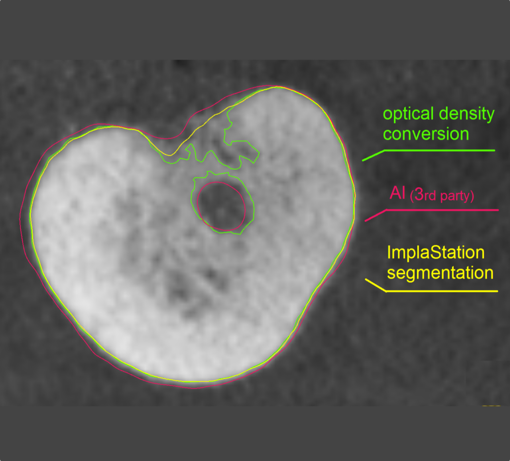 DICOM data segmentation in our latest update