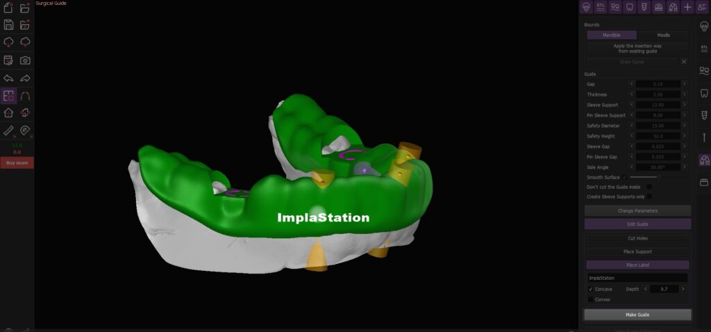 Videos Archive - Page 3 of 5 - Surgical guides & Implantation planning ...