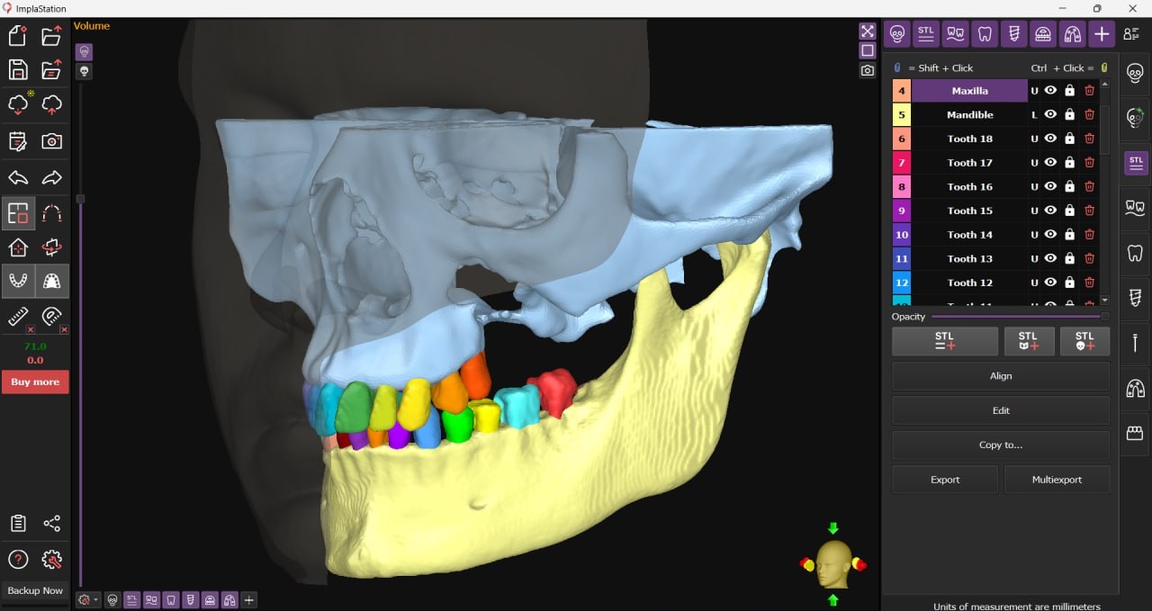 auto segmentation