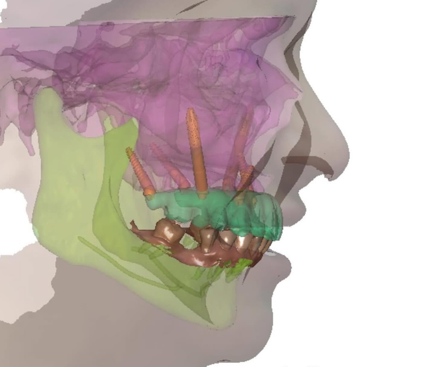 “4-D Surgical Patient” concept