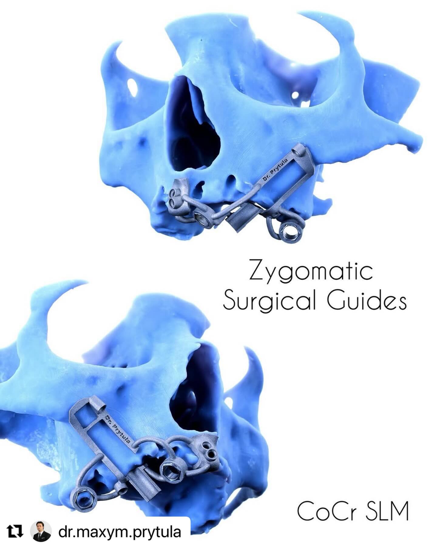 Zygomatic_surgical_guides_ImplaStation