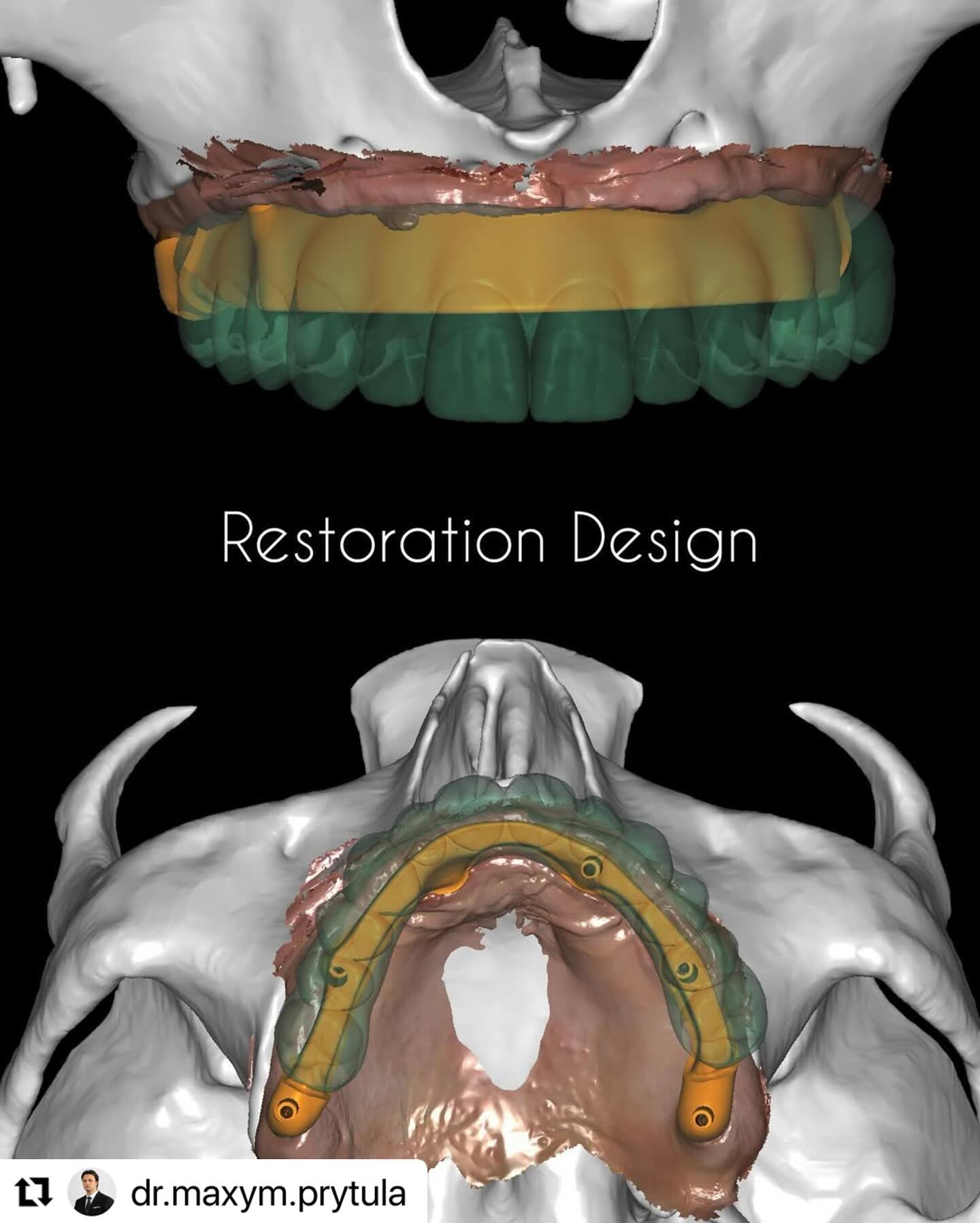 Restoration_design_ImplaStation