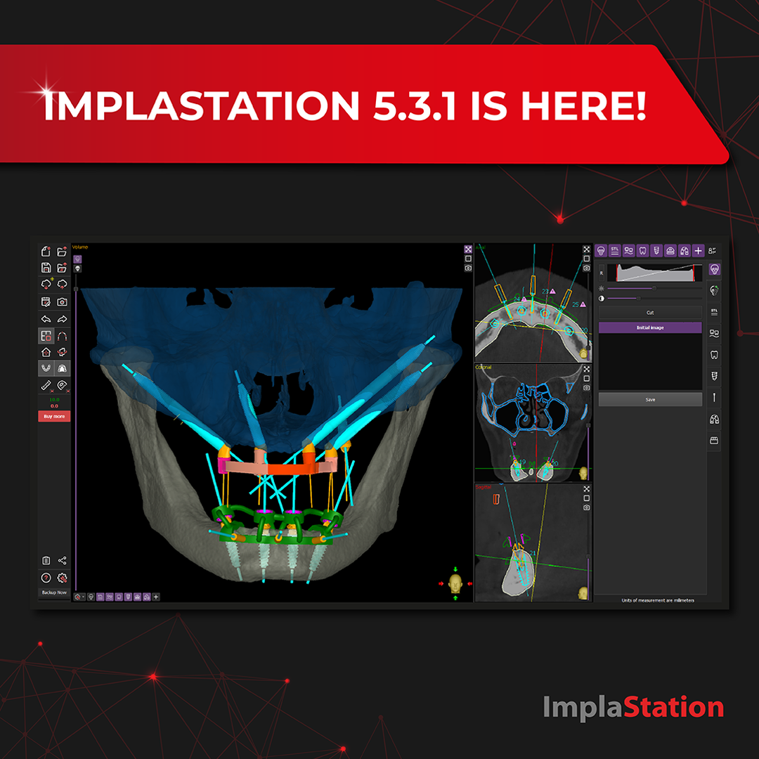 ImplaStation 5.3.0 is here!