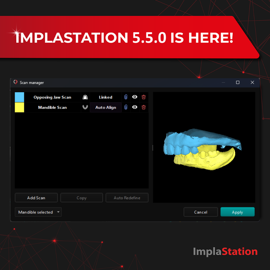 ImplaStation 5.5.0 is here!